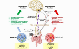 The-gut-brain-axis